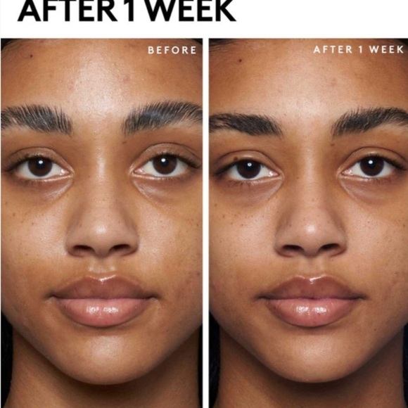 Fenty Skin Mask Cherry Hub 🍒 New in Box - Picture 2 of 4